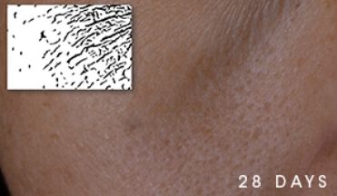Close-up of skin texture labeled '28 DAYS.'