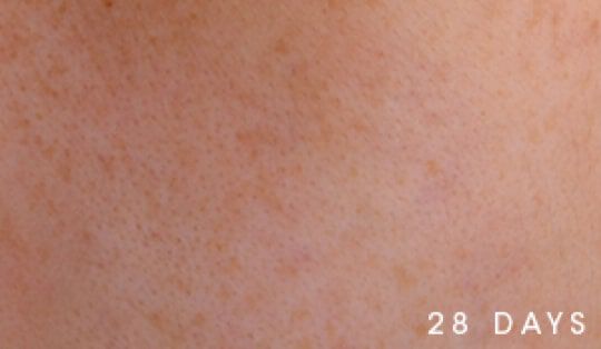 Close-up of skin texture labeled '28 DAYS.'