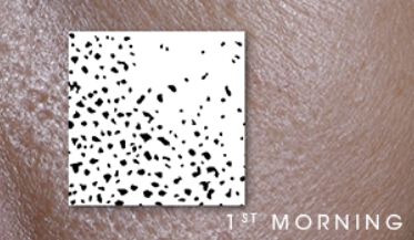 Close-up of skin texture labeled '1st MORNING.'