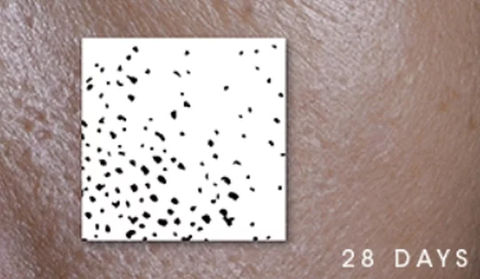 Close-up of skin texture labeled '28 DAYS.'